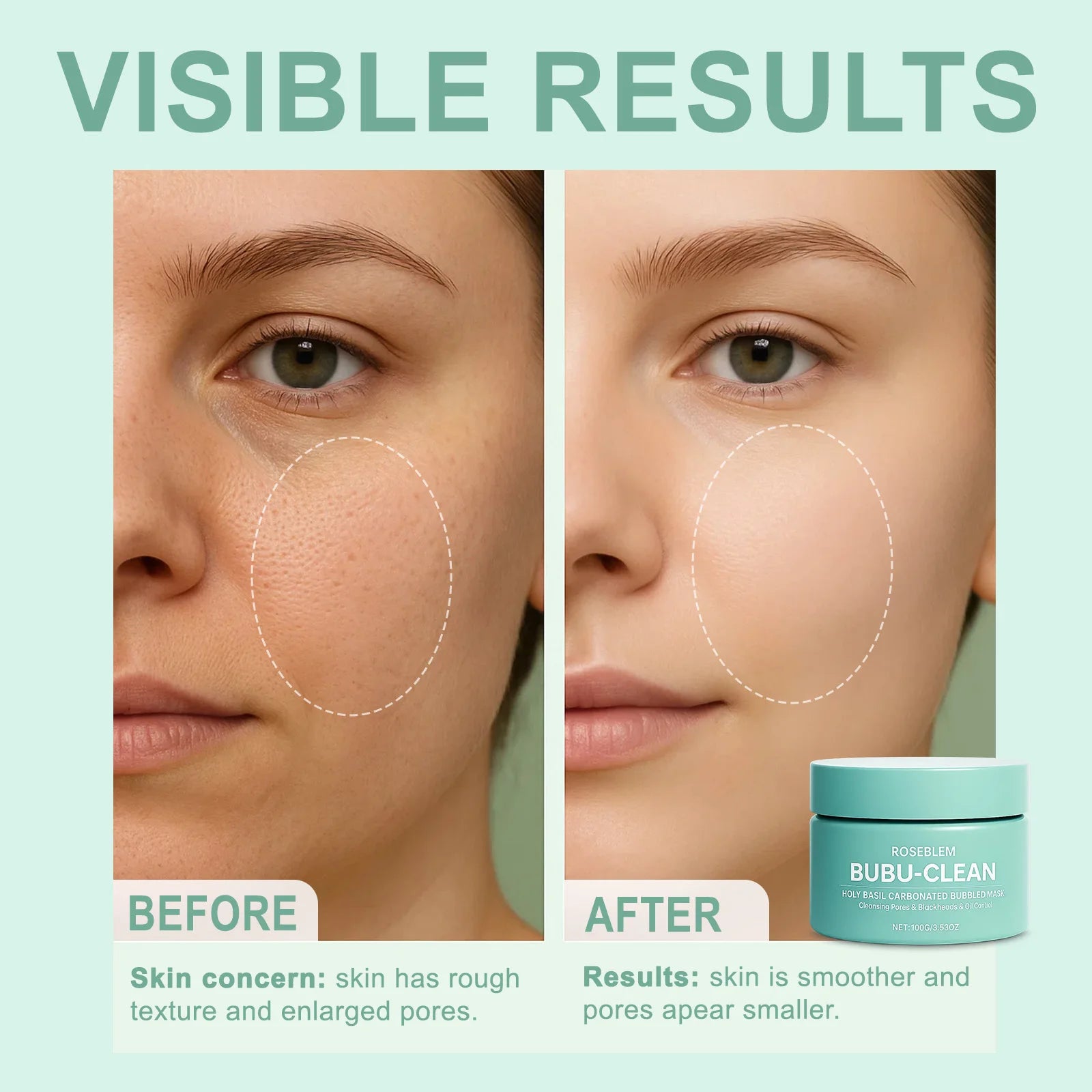 Basil Carbonated Bubble Mask 100g Deep cleansing, Cleans Pores, Removes Blackheads, Controls Oil Suitable For All Skin Types