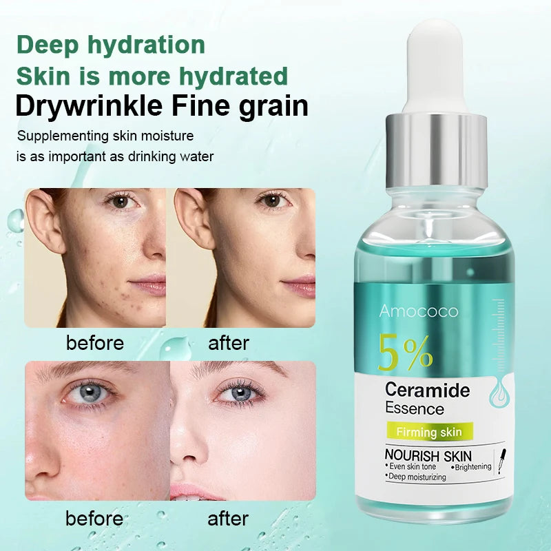 Amococo 2pcs Facial Serum Ceramide Essence 5% Fruit Acid Essence 10% Face Moisturizer Serum with Hyaluronic Acid Hydrating Brightening Skin Care Essence Lightweight Daily Skincare for Women Men 30ml