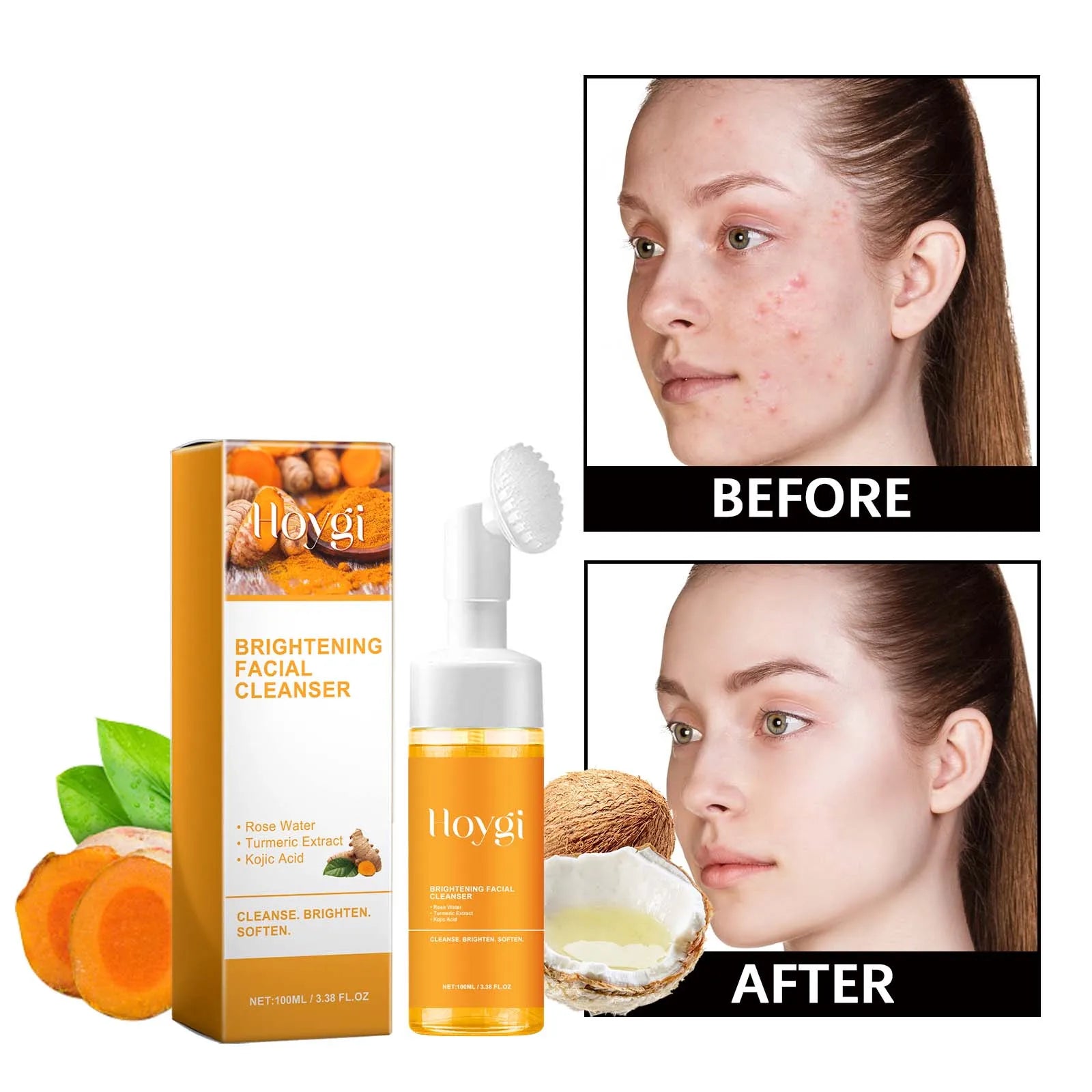Turmeric&Kojic Acid Cleanser with Rose Hydrosol for Effective Soothing&ydration,Brightens the Complexion&Evens Out Skin Texture.